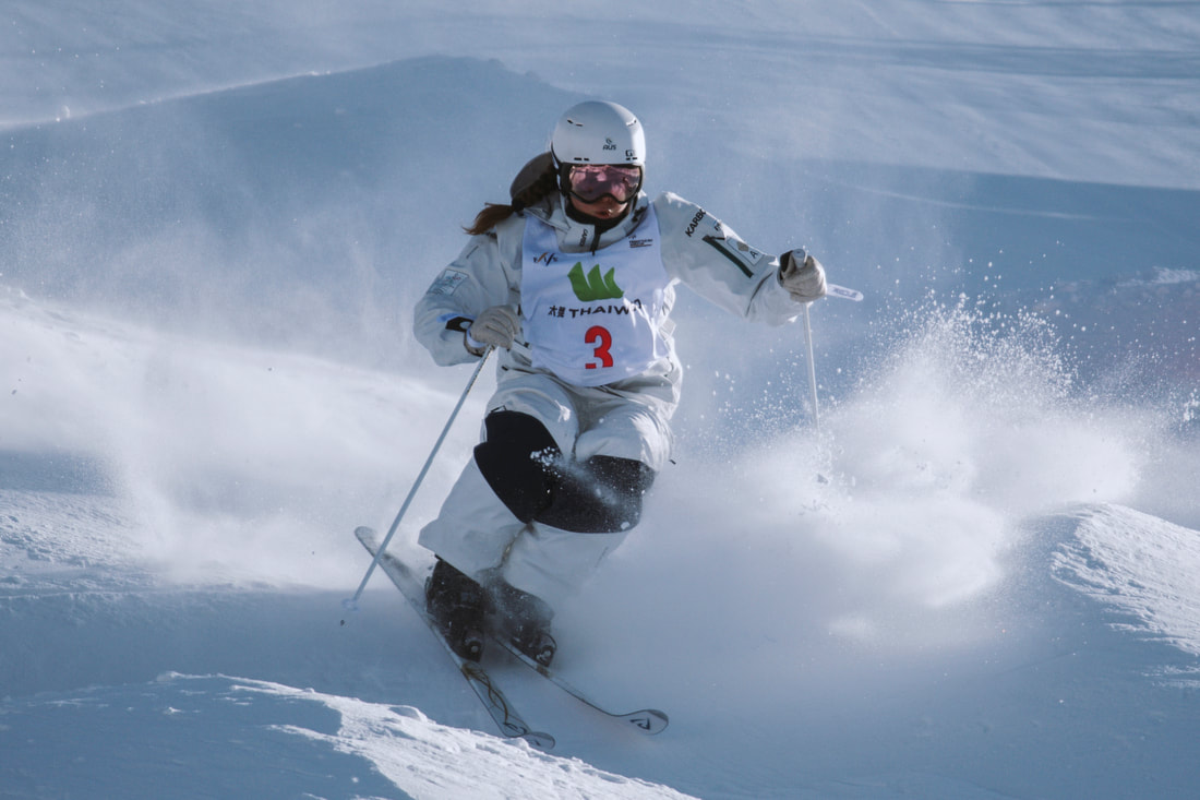 Bumps on and off the slopes for moguls skier Troy Murphy